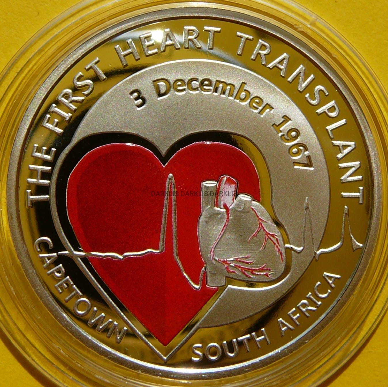 5 EURO BELGIA 2017 - PIERWSZA TRANSPLANTACJA SERCA